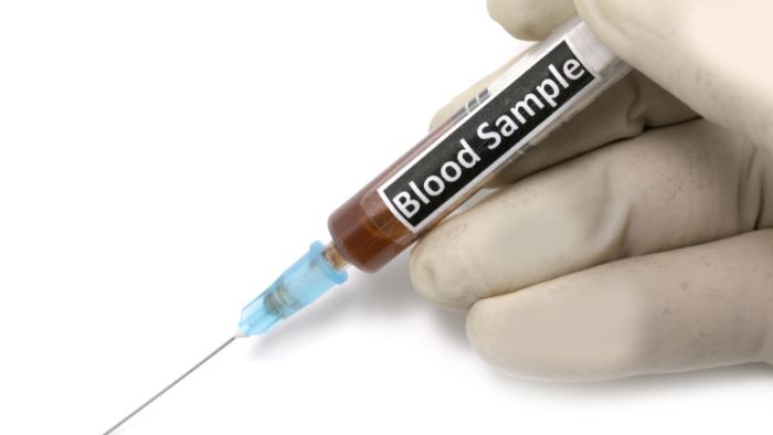 syringe with blood label